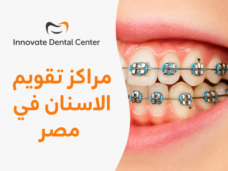 Orthodontic Centers In Egypt